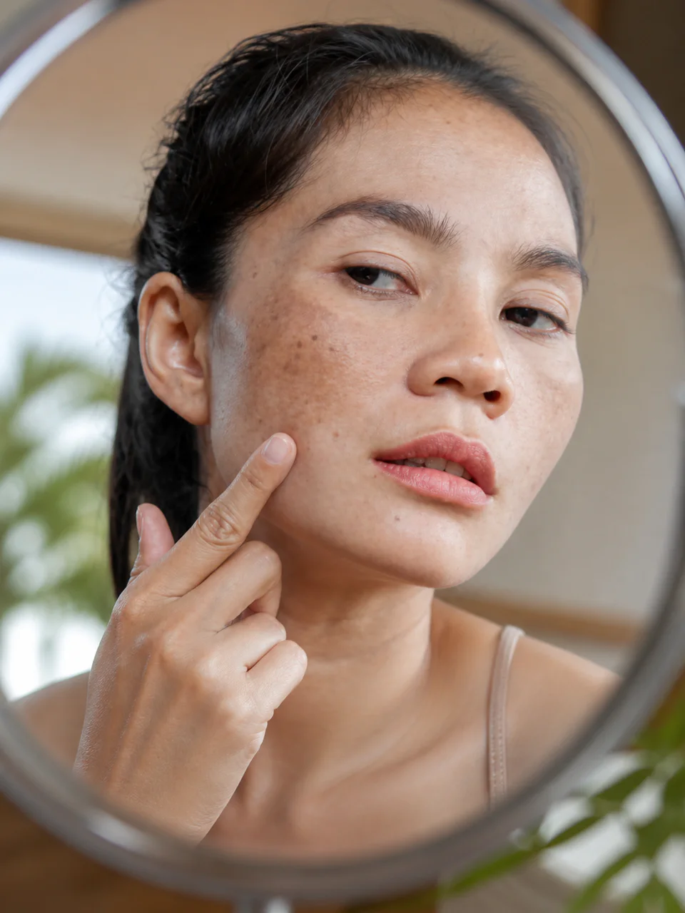 Southeast Asian woman examining melasma pigmentation on her cheek in a mirror