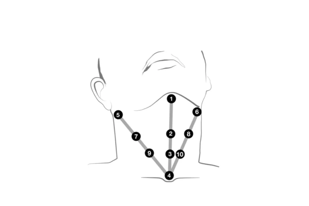 profhilo neck markings before procedure