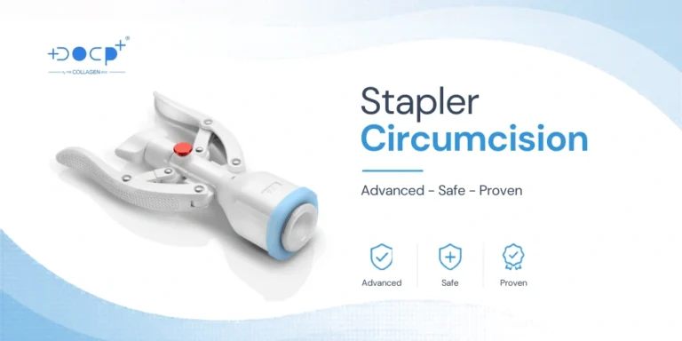 Modern stapler circumcision clinic JB Dr Plus